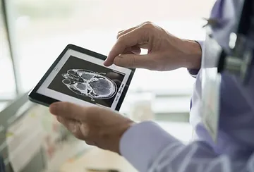 A doctor holding an ipad with a picture of a head.
