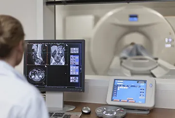 A computer screen showing an mri scan and another monitor.