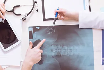 A doctor pointing to an x-ray on the table