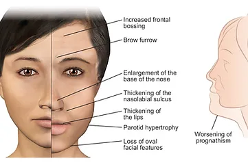A woman 's face with the features of facial muscles.
