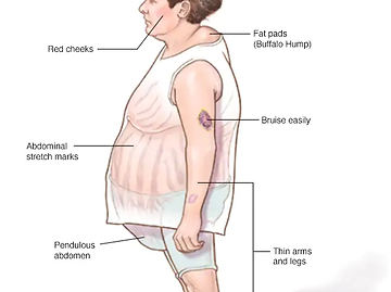 A woman with a large belly has various medical conditions.